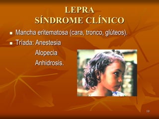 LEPRA
           SÍNDROME CLÍNICO
   Mancha eritematosa (cara, tronco, glúteos).
   Tríada: Anestesia
            Alopecia
            Anhidrosis.




                                                  10
 