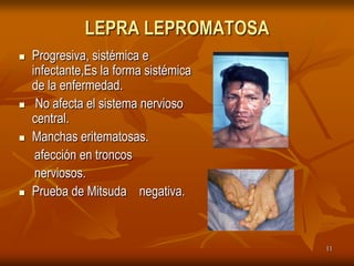 LEPRA LEPROMATOSA
   Progresiva, sistémica e
    infectante,Es la forma sistémica
    de la enfermedad.
    No afecta el sistema nervioso
    central.
   Manchas eritematosas.
     afección en troncos
     nerviosos.
   Prueba de Mitsuda negativa.


                                       11
 