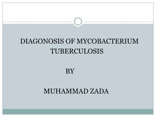 DIAGONOSIS OF MYCOBACTERIUM
TUBERCULOSIS
BY
MUHAMMAD ZADA
 