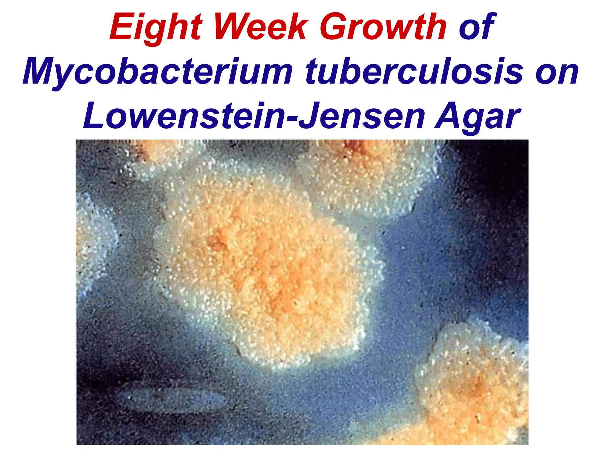 Eight Week Growth of
Mycobacterium tuberculosis on
Lowenstein-Jensen Agar
 