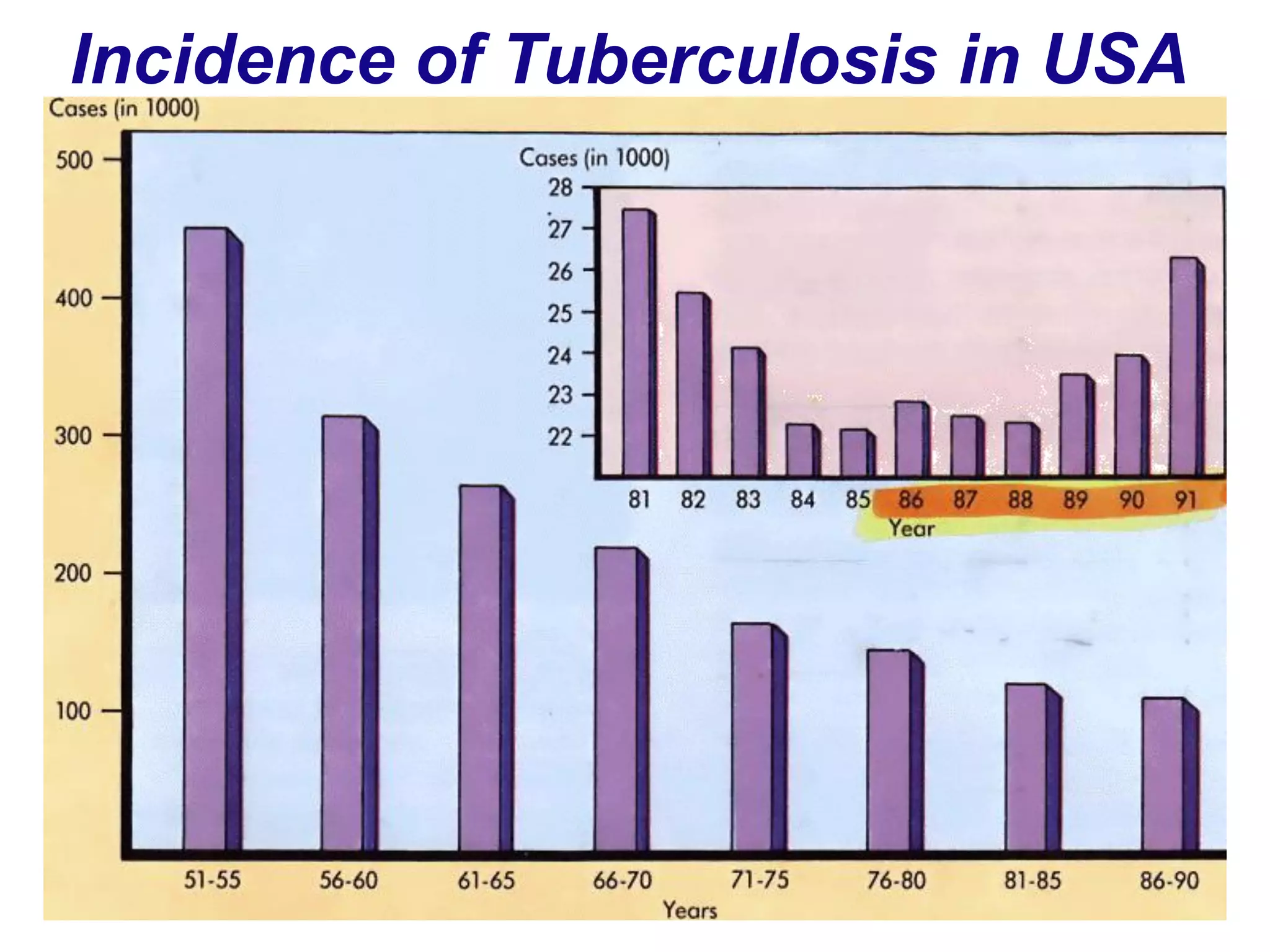 Incidence of Tuberculosis in USA
 
