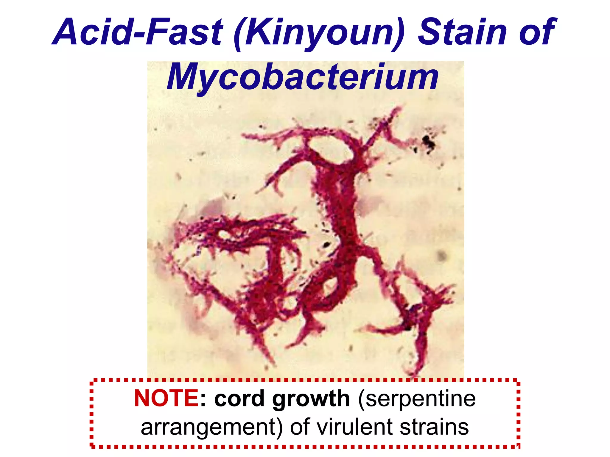 Acid-Fast (Kinyoun) Stain of
Mycobacterium
NOTE: cord growth (serpentine
arrangement) of virulent strains
 