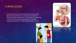 TUBERCULOSIS 
• La tuberculosis es una enfermedad infecciosa que suele 
afectar a los pulmones y es causada por una bacteria 
(Mycobacterium tuberculosis). Se transmite de una persona 
a otra a través de gotículas generadas en el aparato 
respiratorio pacientes con enfermedad pulmonar activa. 
 
