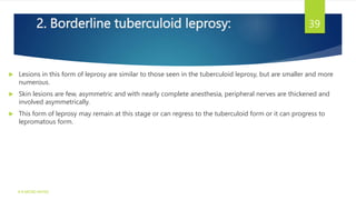 2. Borderline tuberculoid leprosy:
 Lesions in this form of leprosy are similar to those seen in the tuberculoid leprosy, but are smaller and more
numerous.
 Skin lesions are few, asymmetric and with nearly complete anesthesia, peripheral nerves are thickened and
involved asymmetrically.
 This form of leprosy may remain at this stage or can regress to the tuberculoid form or it can progress to
lepromatous form.
K R MICRO NOTES
39
 