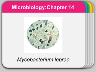 Microbiology:Chapter 14
        WINTER
         Template




 Mycobacterium leprae
 
