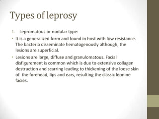 Types of leprosy
1. Lepromatous or nodular type:
• It is a generalized form and found in host with low resistance.
The bacteria disseminate hematogenously although, the
lesions are superficial.
• Lesions are large, diffuse and granulomatous. Facial
disfigurement is common which is due to extensive collagen
destruction and scarring leading to thickening of the loose skin
of the forehead, lips and ears, resulting the classic leonine
facies.
 