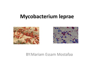 Mycobacterium leprae
BY:Mariam Essam Mostafaa
 