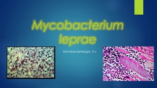 Mycobacterium
leprae
Microbacteriología 2 c
 