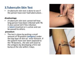 3.Tuberculin Skin Test
• A tuberculin skin test is done to see if
the person have ever had tuberculosis .
disadvantage
• A tuberculin skin test cannot tell how
long person have been infected with TB.
It also cannot tell if the infection
is latent (inactive) or is active and can
be passed to others.
procedure
• The test is done by putting a small
amount of TB protein (antigens) under
the top layer of skin on inner forearm. If
the patient have ever been exposed to
the TB bacteria , the skin will react to
the antigens by developing a firm red
bump at the site within 2 days.
 