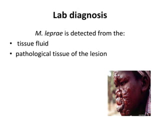 Lab diagnosis
M. leprae is detected from the:
• tissue fluid
• pathological tissue of the lesion
 