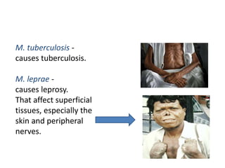 M. tuberculosis -
causes tuberculosis.
M. leprae -
causes leprosy.
That affect superficial
tissues, especially the
skin and peripheral
nerves.
 