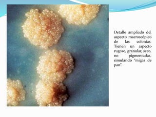 Detalle ampliado del
aspecto macroscópico
de las colonias.
Tienen un aspecto
rugoso, granular, seco,
no pigmentadas,
simulando “migas de
pan”.
 
