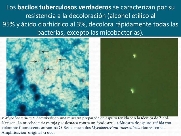 El hongo en los pies el ungüento de los hoyos