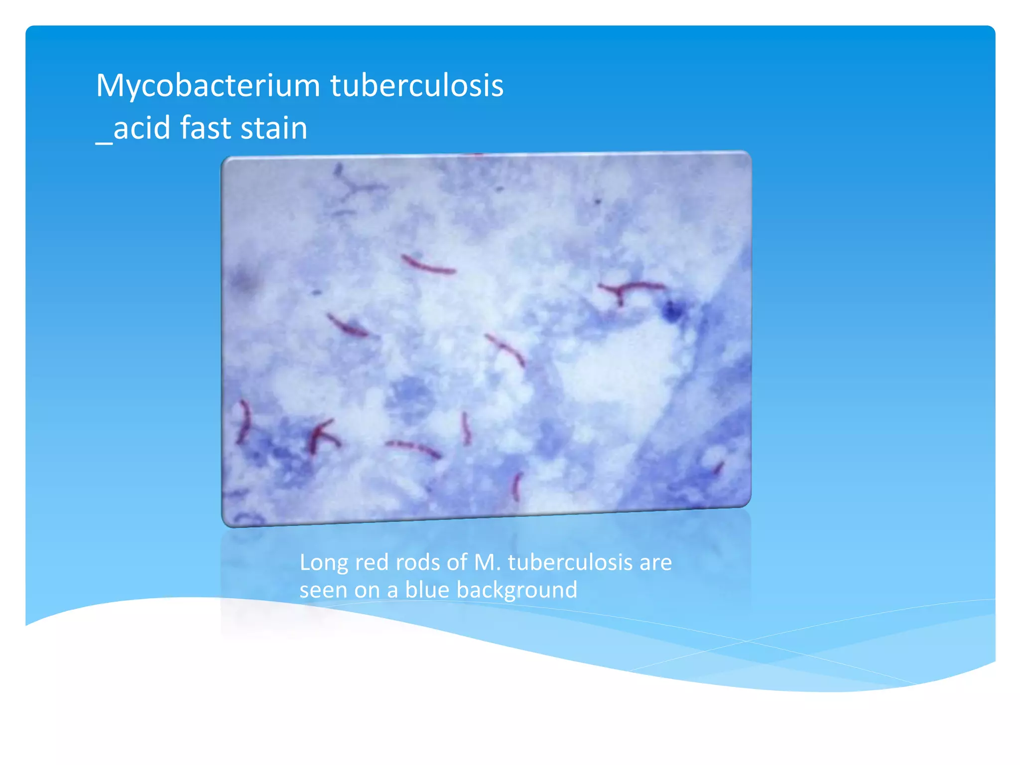 Mycobacterium tuberculosis
_acid fast stain
Long red rods of M. tuberculosis are
seen on a blue background
 