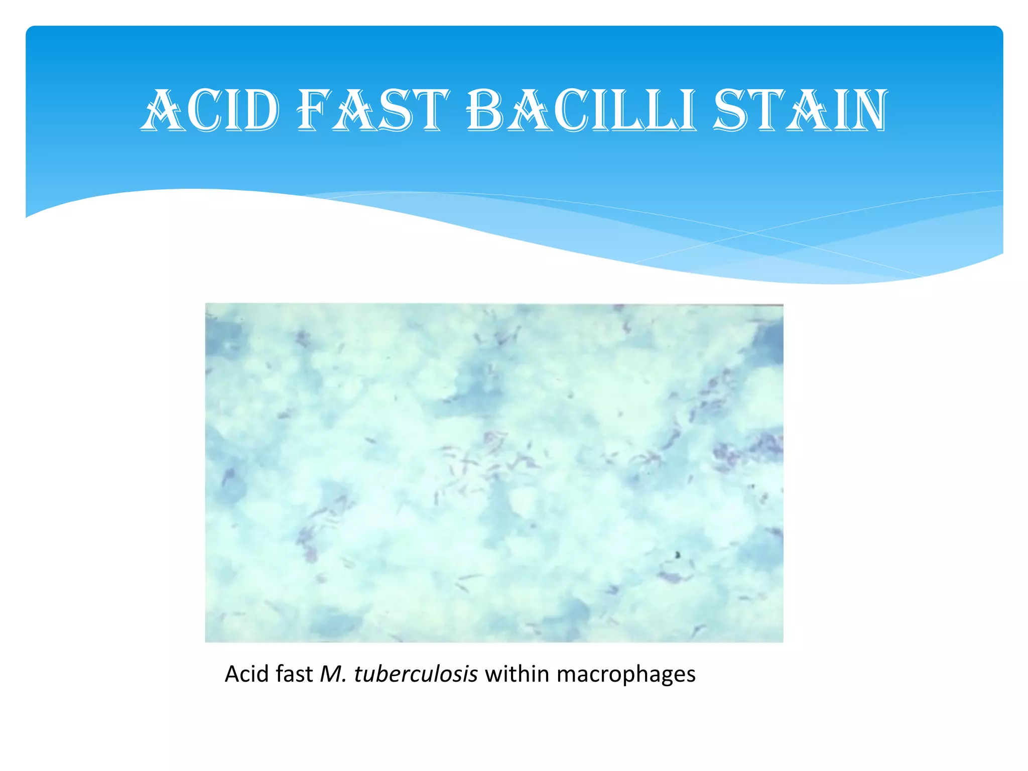 Acid Fast Bacilli Stain
Acid fast M. tuberculosis within macrophages
 