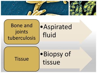 •Aspirated
fluid
Bone and
joints
tuberculosis
•Biopsy of
tissue
Tissue
 