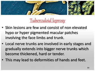 Tuberculoid leprosy
• Skin lesions are few and consist of non elevated
hypo or hyper pigmented macular patches
involving the face limbs and trunk.
• Local nerve trunks are involved in early stages and
gradually extends into bigger nerve trunks which
become thickened, hard or tender.
• This may lead to deformities of hands and feet.
54
 