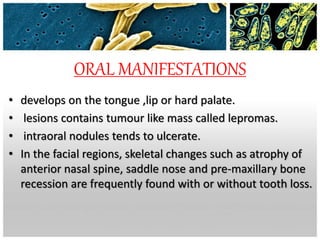 ORAL MANIFESTATIONS
• develops on the tongue ,lip or hard palate.
• lesions contains tumour like mass called lepromas.
• intraoral nodules tends to ulcerate.
• In the facial regions, skeletal changes such as atrophy of
anterior nasal spine, saddle nose and pre-maxillary bone
recession are frequently found with or without tooth loss.
 