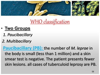 WHO classification
• Two Groups
1. Paucibacillary
2. Multibacillary
Paucibacillary (PB): the number of M. leprae in
the body is small (less than 1 million) and a skin
smear test is negative. The patient presents fewer
skin lesions. all cases of tuberculoid leprosy are PB.
58
 