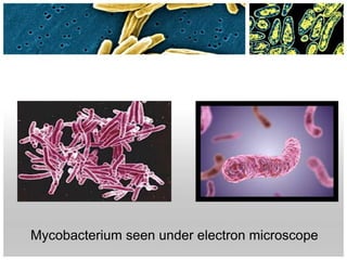 Mycobacterium seen under electron microscope
 