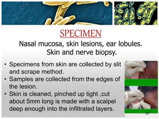 SPECIMEN
Nasal mucosa, skin lesions, ear lobules.
Skin and nerve biopsy.
67
• Specimens from skin are collected by slit
and scrape method.
• Samples are collected from the edges of
the lesion.
• Skin is cleaned, pinched up tight ,cut
about 5mm long is made with a scalpel
deep enough into the infiltrated layers.
 