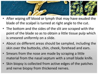 • After wiping off blood or lymph that may have exuded the
blade of the scalpel is turned at right angle to the cut.
• The bottom and the sides of the slit are scraped with the
point of the blade so as to obtain a little tissue pulp which
is smeared uniformly on a slide.
• About six different areas should be sampled, including the
skin over the buttocks, chin, cheek, forehead and ears.
• Smears from the nose are made by scraping a little
material from the nasal septum with a small blade knife.
• Skin biopsy is collected from active edges of the patches
and nerve biopsy from thickened nerves.
 