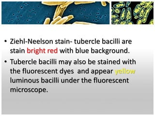 • Ziehl-Neelson stain- tubercle bacilli are
stain bright red with blue background.
• Tubercle bacilli may also be stained with
the fluorescent dyes and appear yellow
luminous bacilli under the fluorescent
microscope.
 