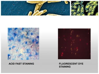 ACID FAST STAINING FLUORESCENT DYE
STAINING
 
