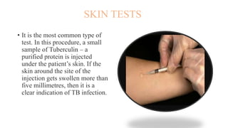 Mycobacterium tuberculosis-TB | PPTX