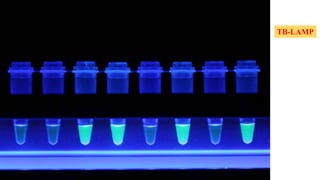 TB-LAMP
 