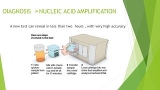 DIAGNOSIS >NUCLEIC ACID AMPLIFICATION
A new test can reveal in less than two hours , with very high accuracy
 