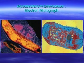 Mycobacterium tuberculosis  :  Electron Micrograph. 