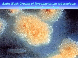Eight Week Growth of Mycobacterium tuberculosis on Lowenstein-Jensen Agar 