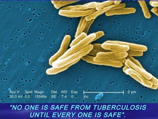 “ NO ONE IS SAFE FROM TUBERCULOSIS UNTIL EVERY ONE IS SAFE”. 