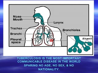 TUBERCULOSIS IS THE MOST IMPORTANT COMMUNICABLE DISEASE IN THE WORLD SPARING NO AGE, NO SEX, & NO  NATIONALITY. 