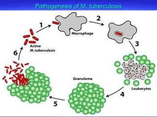 Pathogenesis of M. tuberculosis 