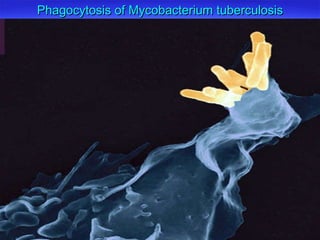 Phagocytosis of Mycobacterium tuberculosis 