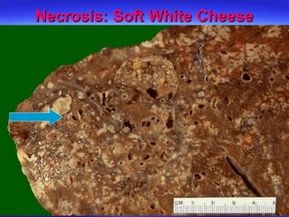 Necrosis: Soft White Cheese 