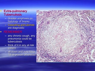 Extra-pulmonary Tuberculosis Greater emphasis on histology of biopsy  Caseating granulomas  are diagnostic REMEMBER any chronic cough, any pneumonia could be tuberculosis think of it in any at risk patient all down and outs have TB till proven otherwise! 