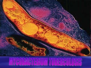 MYCOBACTERIUM TUBERCULOSIS 