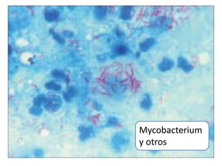 Mycobacterium
y otros
 