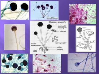 Mycological Loop Mycology | PPTX