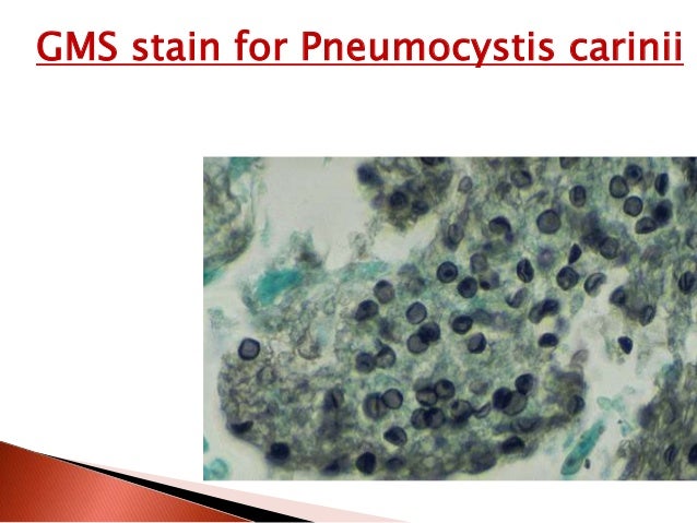gms stain