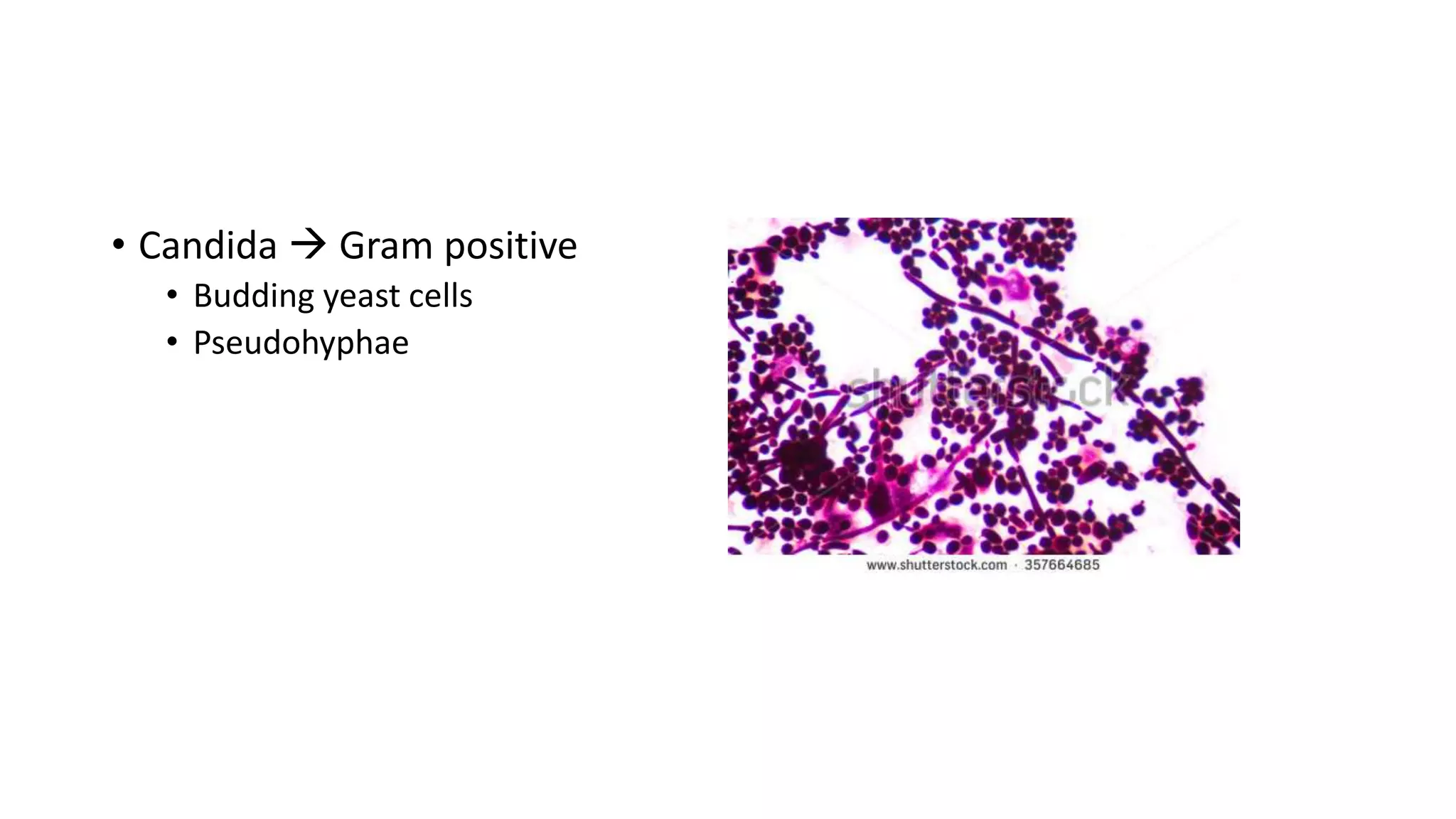 • Candida  Gram positive
• Budding yeast cells
• Pseudohyphae
 
