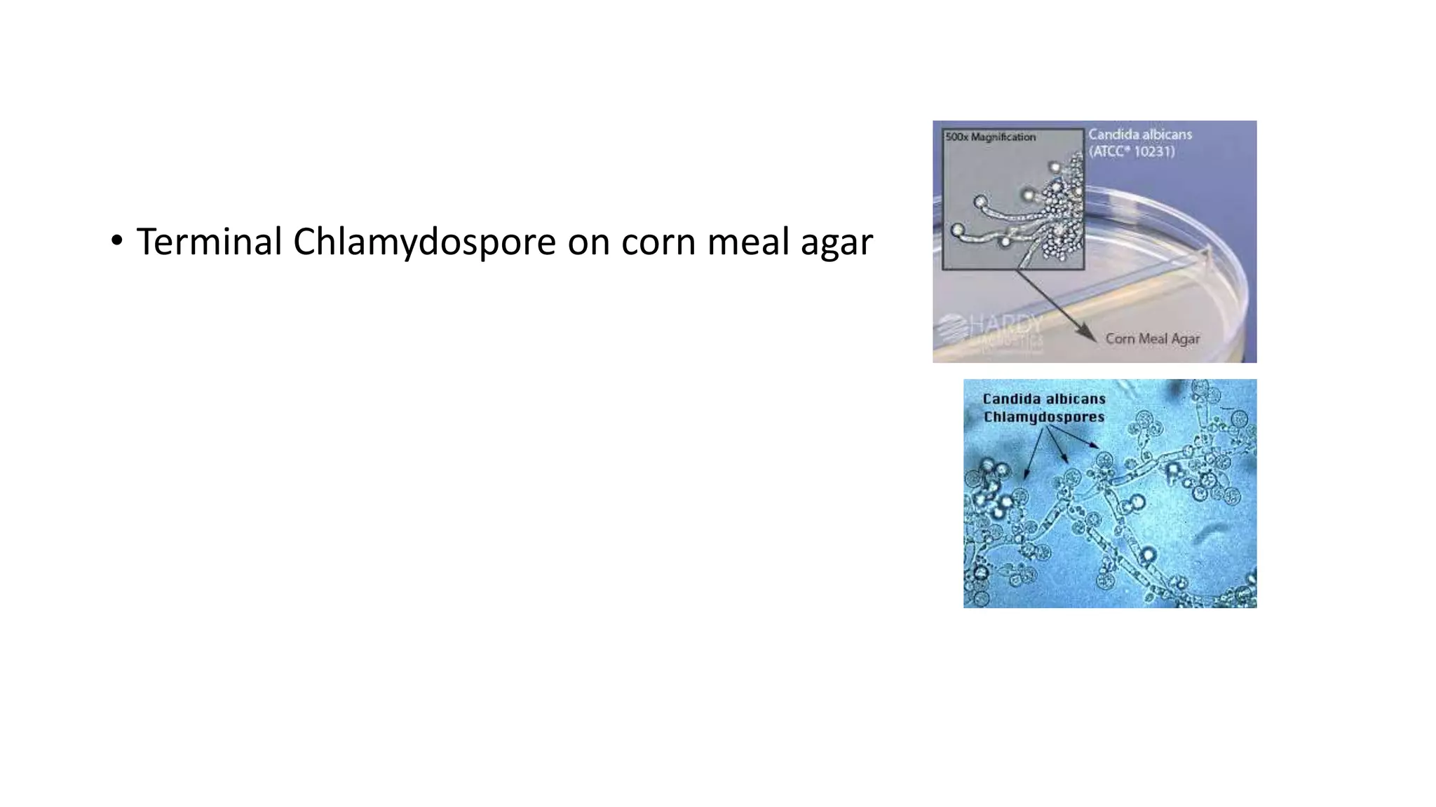 • Terminal Chlamydospore on corn meal agar
 