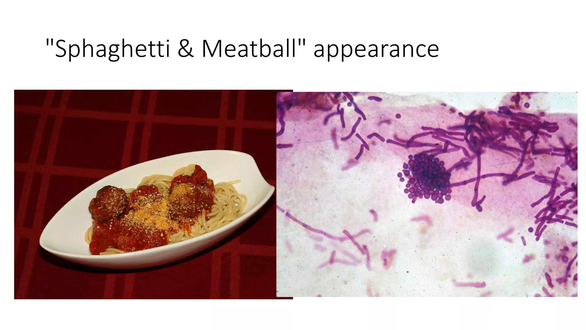 "Sphaghetti & Meatball" appearance
 