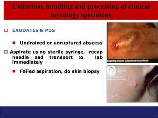 Mycology -introduction and lab diagnosis with QC | PPT