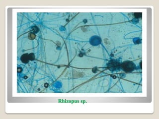 Rhizopus sp.
 