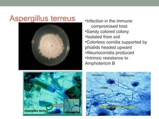 Aspergillus terreus •Infection in the immune
compromised host
•Sandy colored colony
•Isolated from soil
•Colorless conidia supported by
phialids headed upward
•Aleurioconidia produced
•Intrinsic resistance to
Amphotericin B
 