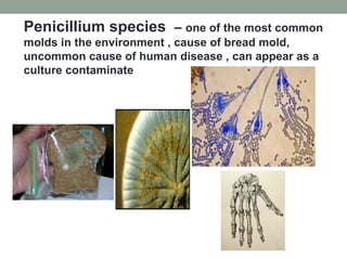 Penicillium species – one of the most common
molds in the environment , cause of bread mold,
uncommon cause of human disease , can appear as a
culture contaminate
 
